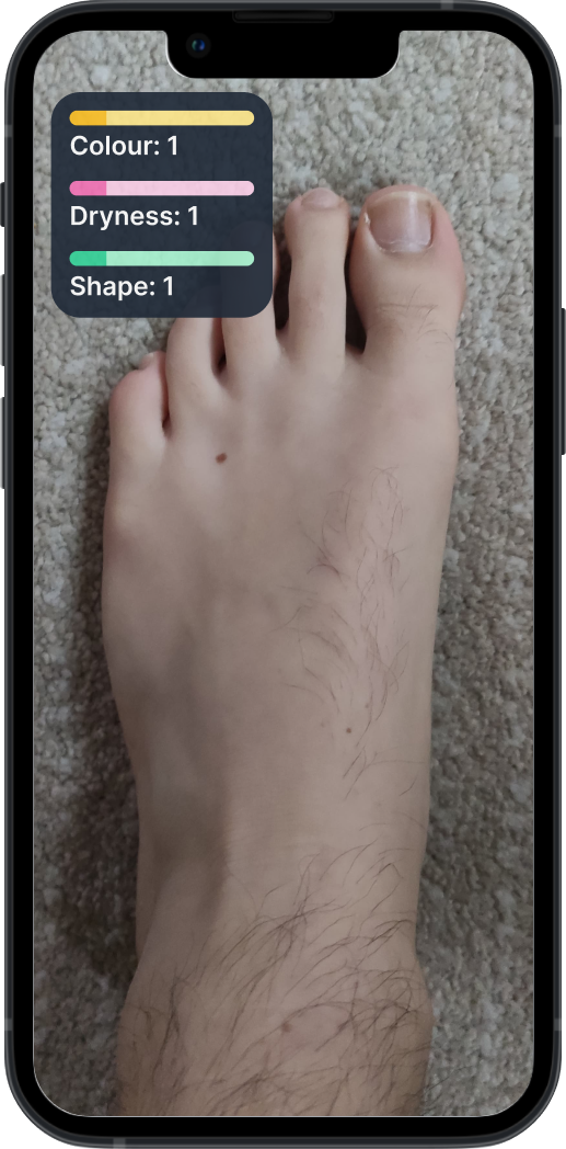 footwatch top foot